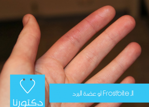 الـ Frostbite