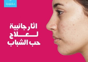 الآثار الجانبية لعلاج حب الشباب