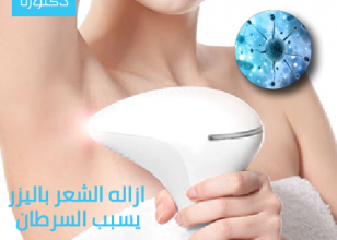 إزالة الشعر بالليزر يسبب السرطان !