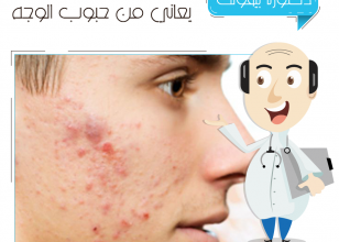 حبوب الوجه