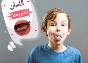 اللسان المربوط؟