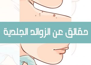 الزوائد الجلدية