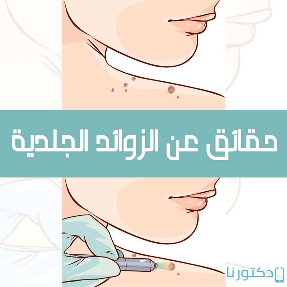 الزوائد الجلدية