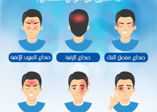 ما هى انواع الصداع؟