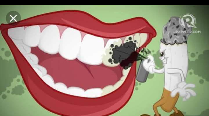 التدخين ومشاكل الأسنان