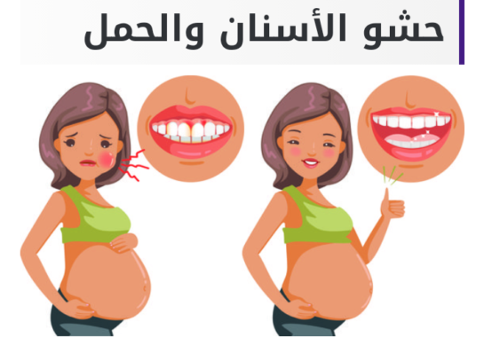 أسباب آلام الأسنان ونزيف اللثه أثناء الحمل وطرق العنايه بها